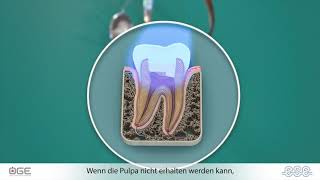 Endodontic Treatments  Austrian version [upl. by Ayisan]