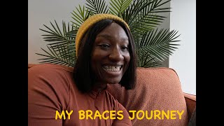 Getting Braces In My 30s  Cost  Insecurities FAQs [upl. by Ayotan]