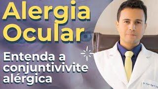 Alergia Ocular Entenda a conjuntivite alérgica conjuntivite olhovermelho drvictorfrança [upl. by Mcdade]