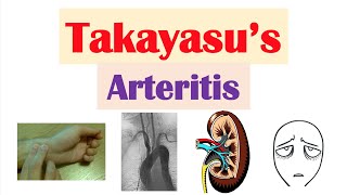 Takayasu’s Arteritis Pulseless Disease  Large Vessel Vasculitis Symptoms Diagnosis Treatment [upl. by Vogeley]