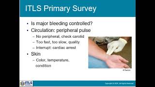 ITLS Trauma Assessment and Management [upl. by Eaton392]