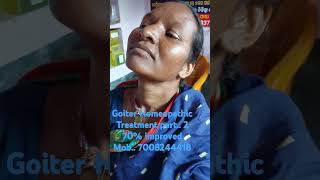 Goitre Homeopathic Treatment Part 2 Improved 70 [upl. by Molton]