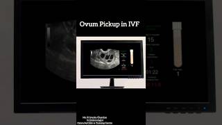 The Incredible Science Behind IVF Egg Retrieval [upl. by Ehrsam]