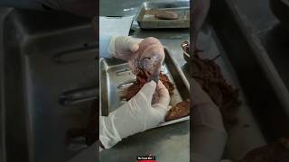 Uterus Anatomy  Real Organ  MBBS  Dissection Hall  human anatomyshortsuterusrevisiontricks [upl. by Ellesij]