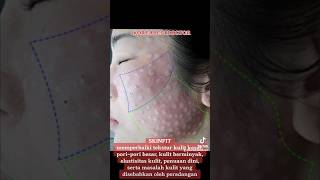 SkinFit Treatment With Koreabestdoctor operasiplastikkorea skintreatment skincarekorea oplas [upl. by Annabela]