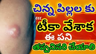 చిన్న పిల్లలకు టీక కు చీము వస్తే ఇలా చేయాలి  BCG vaccine for newborn baby care  BCG vaccine pus [upl. by Leirua]