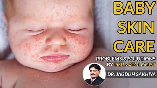 Baby Skin Care Tips  Babys Skin problems amp Solution by Dermatologist  in Hindi [upl. by Combs]