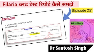 How To Read Filaria Blood Test Report Dr Santosh Singh Episode 25 [upl. by Emanuele]