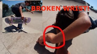 BROKE MY WRIST AT OB SKATEPARK [upl. by Wailoo200]