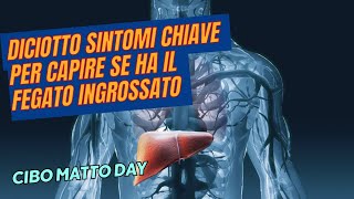 18 Sintomi di Ingrossamento del Fegato Come Identificarli e Prevenirli [upl. by Nylzzaj582]