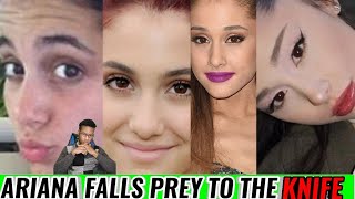 Ariana Grande Ruined Her Face With This Extreme Facial Surgery [upl. by Ofelia]