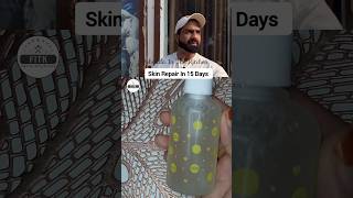 Skin Repair Solution In 15 Days By Famous Coach 💪 Nitesh Soni fehmidainthekitchen skincare nitesh [upl. by Dory]