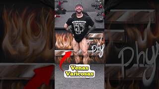 Serpientes en el cuerpo🐍 venas fitness viral [upl. by Eduard]