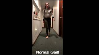 Antalgic Gait Demonstration [upl. by Enitnatsnoc12]