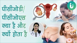 पॉलीसिस्टिक ओवरी सिंड्रोम  PCOD या PCOS का कारण क्या होता है  PCOD or PCOS causes in hindi [upl. by Ava531]