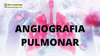 ANGIOGRAFIA PULMONAR [upl. by Hsemar]