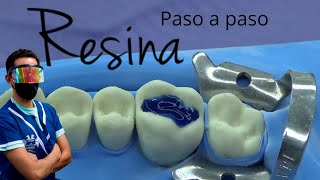 Como hacer una resina dental paso a paso [upl. by Aizirk]