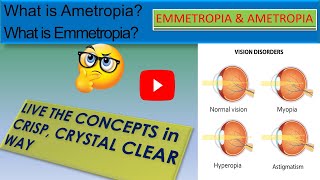 WHAT IS EMMETROPIA  WHAT IS AMETROPIA [upl. by Vil719]