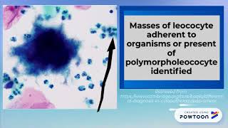 NILM Actinomyces 2018 [upl. by Rehportsirhc]