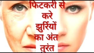 Fitkari फिटकरी से करे झुर्रिया को अंत तुरंत Fitkari ke fayde Alum [upl. by Pelson31]