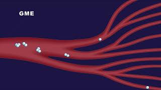 Spectrum Medicals Dual Chamber Oxygenator Technology for OR [upl. by Faustena]