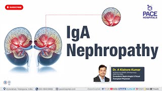 IgA Nephropathy  Reason Symptoms Diagnosis amp Treatments  Glomerular Disease  CKD [upl. by Prince710]