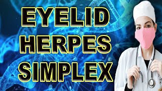 eyelid herpes simplex [upl. by Sihon]