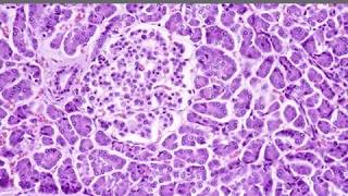 Biochemical Basis of Diabetes Mellitus [upl. by Jennie555]