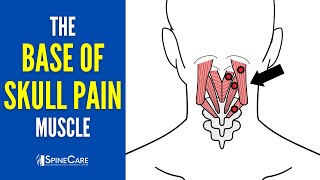 The Base of the Skull Pain Muscle How to Release It for INSTANT RELIEF [upl. by Johanna]