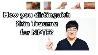 Skin trauma Contusion Ecchymosis Petechiae Laceration Abrasion NPTE topics [upl. by Nonarb]