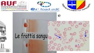 MORPHOLOGIE EN HEMATOLOGIE EPISODE 6 [upl. by Illom]