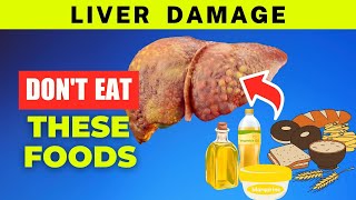 Liver Damage Alert Avoid These 7 Toxic Eats [upl. by Robert731]