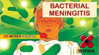 Bacterial Meningitis [upl. by Nirrok]