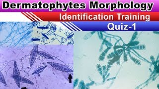 Dermatophytes Morphology Identification Quiz 1 [upl. by Maddox]