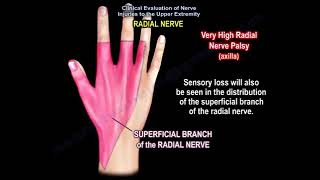 radial nerve injury wrist drop anatomy of the radial nerve [upl. by Lyda16]