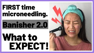 Banisher 20 First Impressions Dermastamping  Microneedling for Acne and Textured Skin [upl. by Dick]