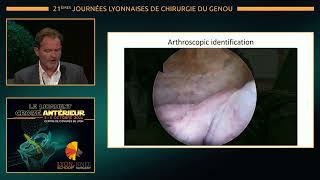 JLG24 J2 Sympo Arthrex [upl. by Nnyltiac]