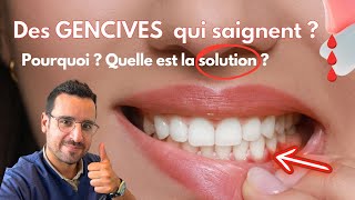 Explication GENCIVE qui SAIGNE  la solution [upl. by Mauve]