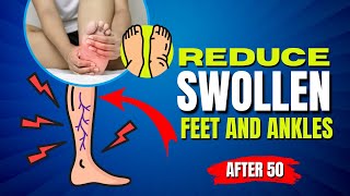 What to Do If You Got Swollen Feet and Ankles Here are 6 Easy Solutions [upl. by Stanleigh]