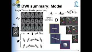 STOR701002 Lecture3 Diffusionweighted imaging and diffusion tensor image analysisI [upl. by Wills779]