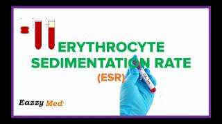 Erythrocyte Sedimentation Rate ESR Made Simple [upl. by Englebert]