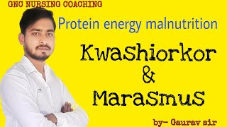 Protein energy malnutrition kwashiorkor and marasmus [upl. by Kirsteni]