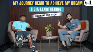 Tibia Limb Lengthening Surgery Journey for Gaining 78 cm Height  Limb lengthening Surgery [upl. by Jamnes]