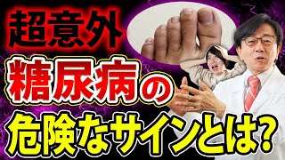 【放置厳禁】知らないと後悔する糖尿病の初期症状はコレ！絶対見逃さないで！ [upl. by Acimat]