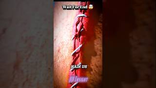 How stitches work 🤔 shorts viral facts trendingshorts viralvideo [upl. by Sergo972]