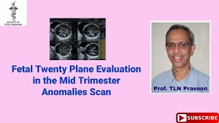 Fetal Twenty Plane Evaluation in the Mid trimester Anomalies Scan [upl. by Brana]