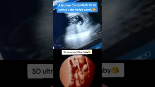 16 weeks movement clear seen on ultrasound🥰🥰viralvideo trending viralshorts [upl. by Erdnaed21]