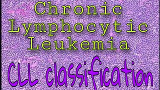 Chronic Lymphocytic Leukemia [upl. by Larry532]