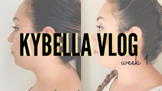 KYBELLA WEEK 1 VLOG  Full Process  Procedure  Downtime  Results  Before amp After [upl. by Kirad]