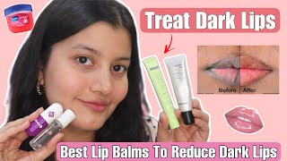 FINALLY Found The Best Lip Balms To Lighten DARK LIPS [upl. by Sven]